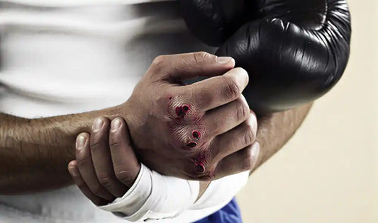 Signs You Need New Boxing Gloves